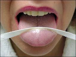 Mau hálito: Impactos da halitose SUA vida.